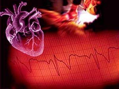 Симптомы инфаркта миокарда и его профилактика