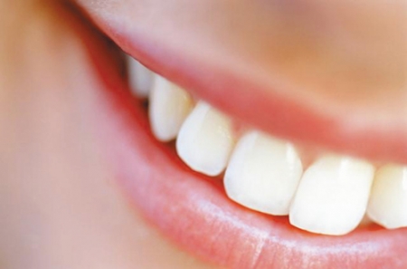 Имплантация зубов - для чего она нужна