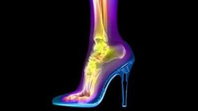 Ортопеды не советуют носить обувь на высоких каблуках